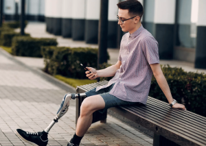 Ảnh Khách hàng sau khi đã lắp chân giả trên gối