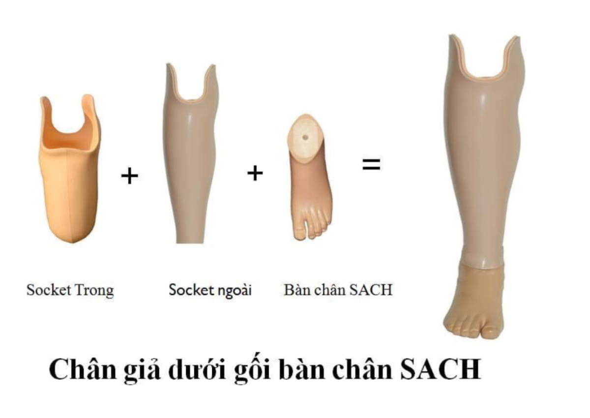 Cấu tạo của chân giả dưới gối