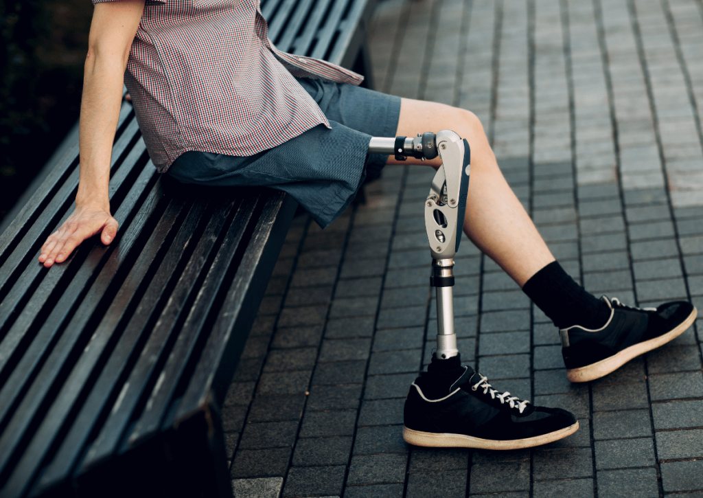 Người sử dụng chân giả tháo khớp háng